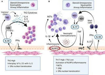 Frontiers | Immunobiology of Steroid-Unresponsive Severe Asthma | Allergy (and clinical immunology) | Scoop.it