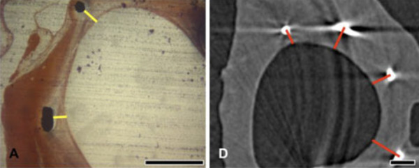 Micro-CT and Histological Evaluation of an Neural Interface Implanted Within a Blood Vessel | Brain Computer Interfaces & connected medical devices | Scoop.it