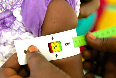 With UNICEF Wearables Get to Those Who Actually Need Them | Digital Health | Scoop.it