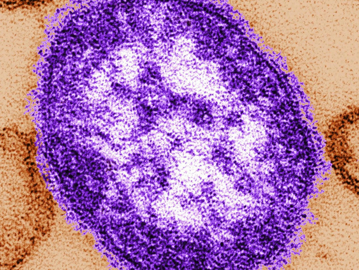 New travel-related measles case found in the Lower Mainland | The Health Report | Scoop.it