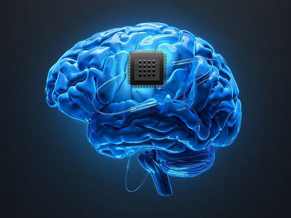 Have brain-computer interfaces finally arrived? | Brain Computer Interfaces & connected medical devices | Scoop.it