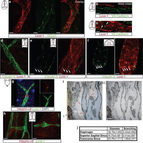 Structural and functional features of central nervous system lymphatics | Immunology for University Students | Scoop.it