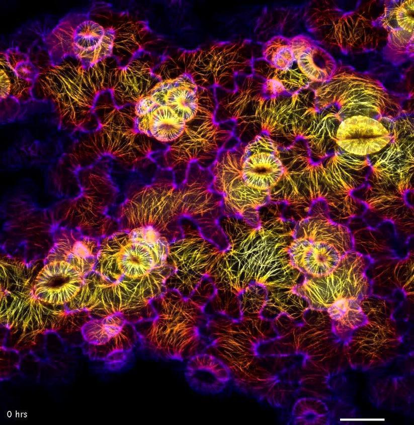 Вирус в стиле. Fluorescent cytoskeleton sem. Клетки создающие ритм. Pavement Cells. Cytoskeleton structure photo 2021.