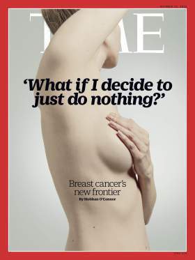 Why Doctors Are Rethinking Breast-Cancer Treatment - TIME | Disease mongering | Scoop.it
