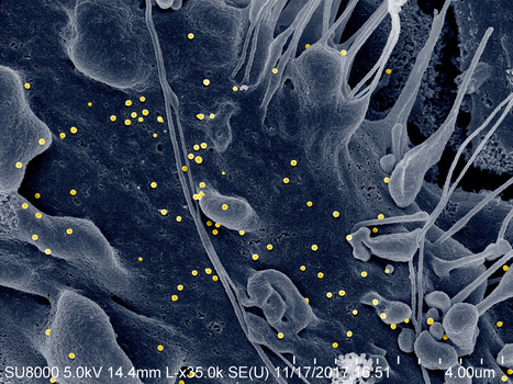 A novel model for Crimean-Congo hemorrhagic fever virus | Virology News | Scoop.it