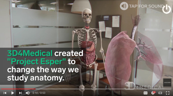 The future of medical learning: Complete Anatomy presented in #AugmentedReality | WHY IT MATTERS: Digital Transformation | Scoop.it