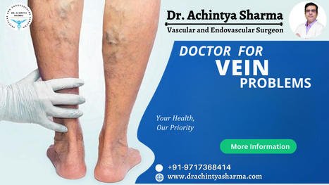 Beyond Bulges: Unveiling the Role of a Doctor for Vein Problems | Dr. Achintya Sharma - Vascular and Endovascular Surgeon | Scoop.it
