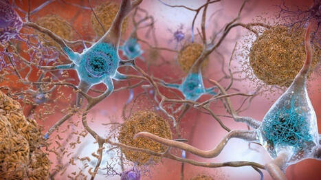 Brain Plasticity: How learning changes your brain | Thinking Clearly and Analytically | Scoop.it
