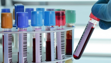 Forte hausse des infections sexuellement transmissibles | sida | Scoop.it