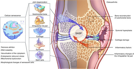 Cross-talk of inflammation and cellular senescence: a new insight into the occurrence and progression of osteoarthritis | Bone Research | Rheumatology-Rhumatologie | Scoop.it