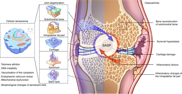 Cross-talk of inflammation and cellular senesce...