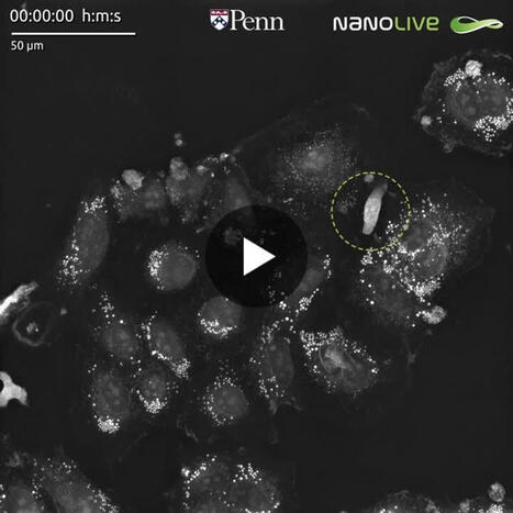 #immunooncology #cart #cancerresearch | Nanolive SA | Immunology and Biotherapies | Scoop.it