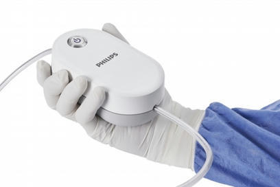 Philips launches small, push-button blood clot removal system | Neurovascular Intervention | Scoop.it