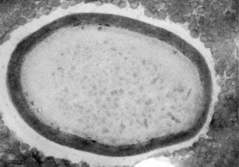 Giant Viruses Evolved from Small Ones by Gene Duplications | Amazing Science | Scoop.it