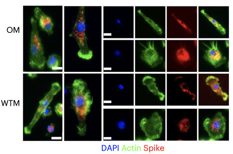 SARS-CoV-2 Viral Persistence in Lung Alveolar Macrophages is Controlled by IFN-γ and NK cells - Nature Immunology | Mucosal Immunity | Scoop.it