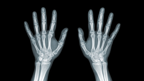 Wrist/Hand Arthritis and Trauma: Diagnostic Imaging | El Paso, TX. Chiropractor | Call: 915-850-0900 | Mobility & Flexibility - Joint Movement | Scoop.it