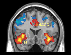 Brain structure helps guide behavior by anticipating changing demands | Science News | Scoop.it