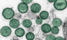 Hantavirus : le gouvernement prend des mesures strictes mais se veut rassurant | Veille juridique du CDG13 | Scoop.it