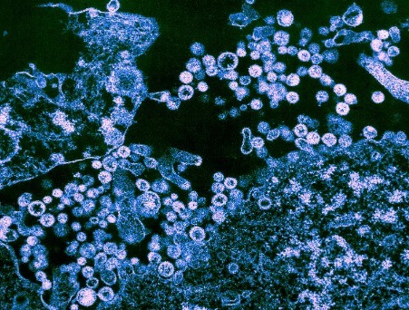 Study Vaccine Protects Monkeys Against Four types of Hemorrhagic Fever viruses | Virus World | Scoop.it