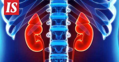 Jatkuva suolan lis&auml;&auml;minen ruokaan haittaa munuaisia &ndash; krooninen munuaistauti on aluksi oireeton | 1Uutiset - Lukemisen t&auml;hden | Scoop.it