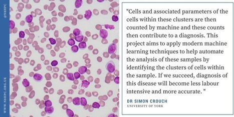 Analysis of Flow Cytometry Data from Patients with Chronic Lymphocytic Leukaemia | N8HPC | from Flow Cytometry to Cytomics | Scoop.it