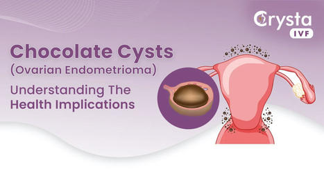 Chocolate Cysts (Ovarian Endometrioma): Causes, Symptoms and Treatment | Fertility Treatment in India | Scoop.it