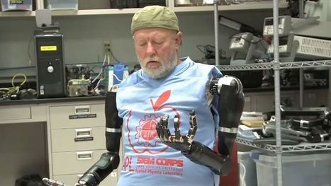 Un Am&eacute;ricain &eacute;quip&eacute; de deux bras bioniques : quand la machine devient le futur de l'homme | Science & Transhumanisme | Scoop.it