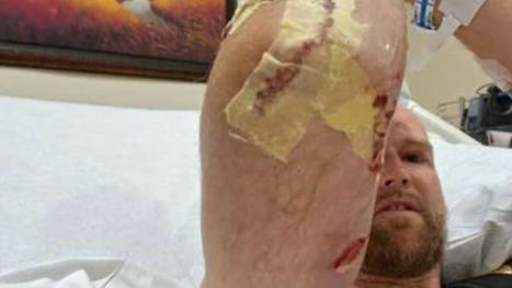 South Carolina diver reveals how he fought off a huge alligator with a SCREWDRIVER after the beast pulled him to the bottom of the river and 'shook him like a rag doll' just as his tank ran out of ... | Soggy Science | Scoop.it