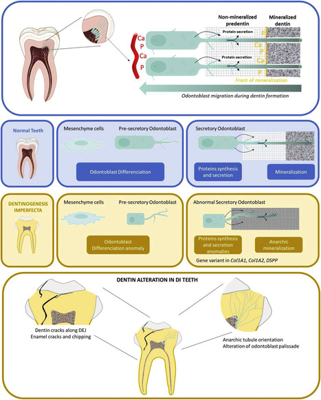 Physiologie de la dentinogenèse et physiopathologie de la dentinogenèse imparfaite : impact sur la structure de la dentine et ses propriétés biomécaniques | Life Sciences Université Paris-Saclay | Scoop.it