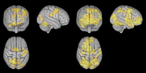How Your Brain Works During Meditation | Fitness, Health, and Wellness | Scoop.it
