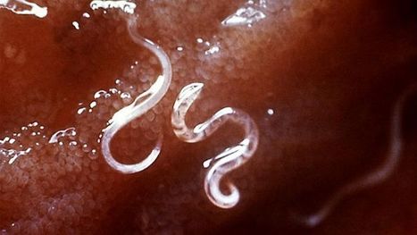 Intestinal worm peptides could treat multiple sclerosis, rheumatoid arthritis | Scl&eacute;rose en Plaques | Scoop.it