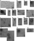 ScienceDirect.com - Research in Microbiology - Diversity of tailed phages in Baltic Sea sediment: large number of siphoviruses with extremely long tails | Virology News | Scoop.it