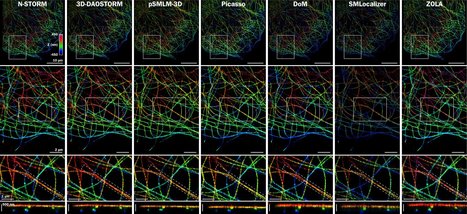 Single molecule localization microscopy allows flexible 3D localization microscopy (ZOLA-3D) over an adjustable axial range | Amazing Science | Scoop.it