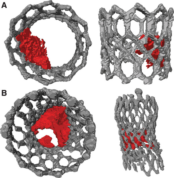 The Fluid Mechanics of Transcatheter Heart Valve Leaflet Thrombosis in the Neosinus | Transcatheter Treatment of Mitral Regurgitation | Scoop.it