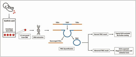 Newborn screening for severe combined immunodeficiency and inborn errors of immunity : Current Opinion in Pediatrics | dépistage néonatal | Scoop.it