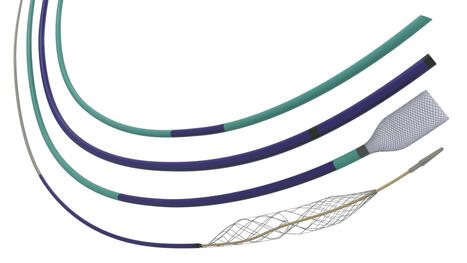 Inari Medical, now part of Stryker, launches Artix thrombectomy system | Neurovascular Intervention | Scoop.it