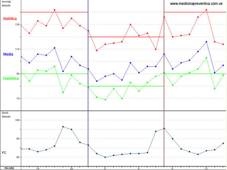 Monitoreo ambulatorio de presion arterial (MAPA) / Holter de presion arterial / Monitoreo ambulatorio de la tension arterial / Holter 24 horas de tensi&oacute;n arterial, Brazaletes de obesos, Norma venez... | Salud Publica | Scoop.it
