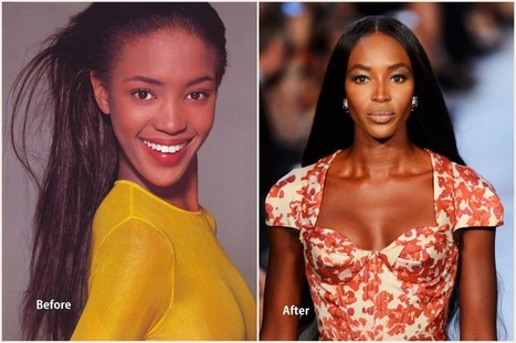 Naomi Campbell Plastic Surgery Before and After...