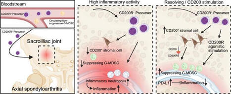 #naturecommunications #immunology #rheumatology #spondyloarthritis #fibroblasts #inflammation #translationalresearch | Andreas Ramming | Rheumatology-Rhumatologie | Scoop.it