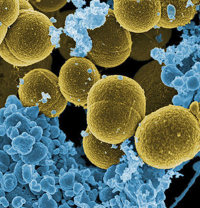 Bactéries : elles survivent jusqu'à une semaine dans les sièges d'avion | Toxique, soyons vigilant ! | Scoop.it
