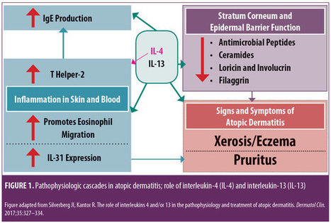 Monoclonal Antibody Therapies for Atopic Dermatitis: Where Are We Now in the Spectrum of Disease Management? : JCAD | The Journal of Clinical and Aesthetic Dermatology | Allergy (and clinical immunology) | Scoop.it