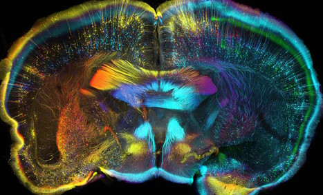 Wellcome Image Awards 2015 showcase breathtaking shots of life, death, and science up close | Amazing Science | Scoop.it