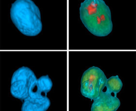 No, A Universal Cancer Vaccine Was Not Just Developed | Virology News | Scoop.it
