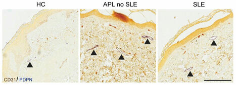 Shining a light on... - Journal of Clinical Investigation | AUTOIMMUNITY | Scoop.it