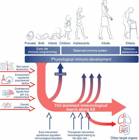 Navigating atopic dermatitis: Challenges and future opportunities | Allergy EAACI posted on the topic | LinkedIn | Allergy (and clinical immunology) | Scoop.it