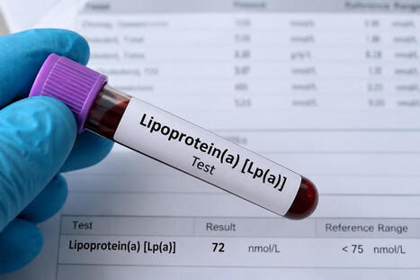Lp(a) : LE MARQUEUR... - Val&eacute;rie Wattenbergh Nutritionniste | Laboratory Medicine | Scoop.it