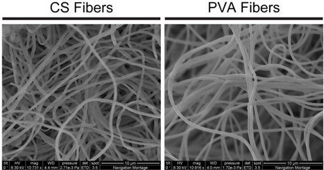 Nanoscale scaffolds spur stem cells to cartilage repair | Immunology and Biotherapies | Scoop.it
