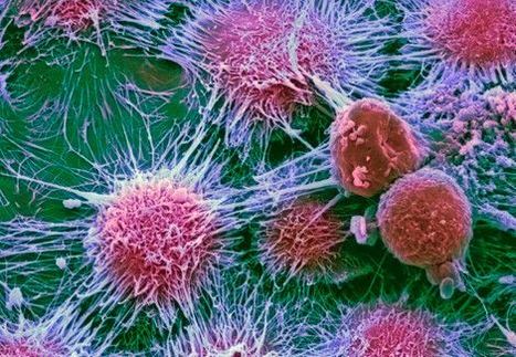 Modulating CD39 expression to enhance CAR-T cell therapy against hepatocellular carcinoma | Genetic Engineering in the Press by GEG | Scoop.it