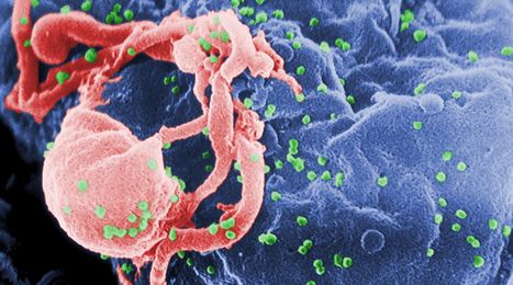 Major setback for AIDS cure: Study finds reservoir of hidden HIV bigger than once thought | Immunopathology & Immunotherapy | Scoop.it