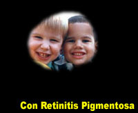 Investigadores identifican dos genes relacionados con la retinitis pigmentaria/IBL NEWS | Salud Visual 2.0 | Scoop.it